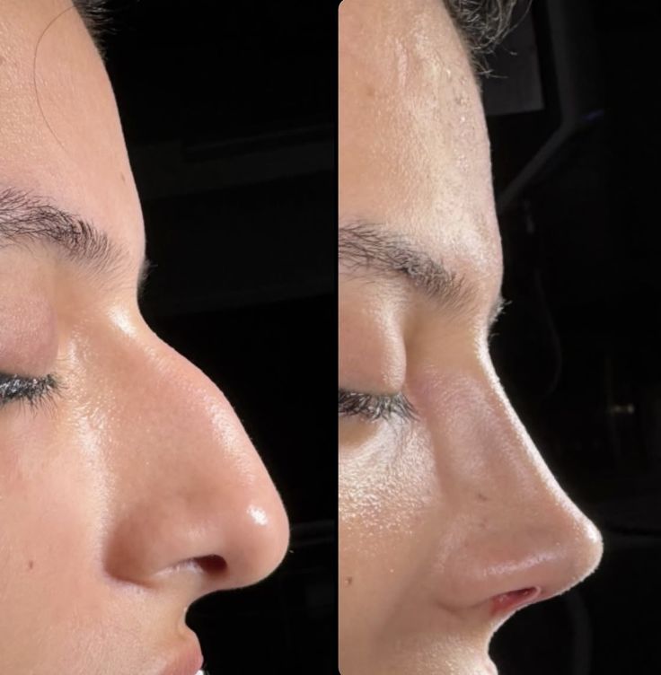 Ästhetik Transformation 2
